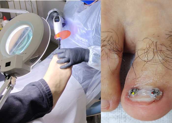 instalacionblacketsimage1-1